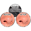 Máscara Facial de Limpeza Remove Cravos e Espinhas
